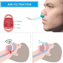 Anti Snoring Device
